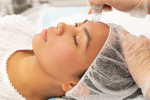 Classic Microdermabrasion Featured Image